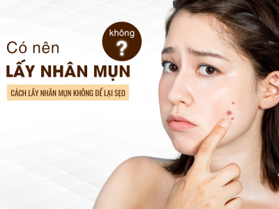 Có Nên Lấy Nhân Mụn Không? 